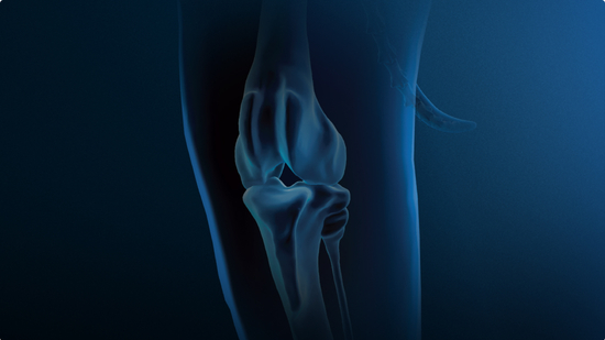 Anatomic representation of the small animal stifle, including the bones and musculature, surrounded by a blue aura.