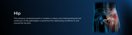 Anatomic representation of the hip, including the bones and musculature, surrounded by a blue aura.